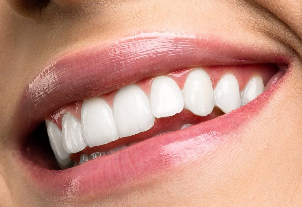 How Cosmetic Dentistry Can Help You